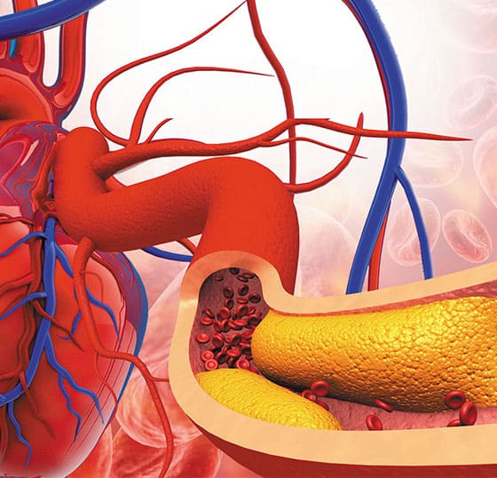 Cholesterol