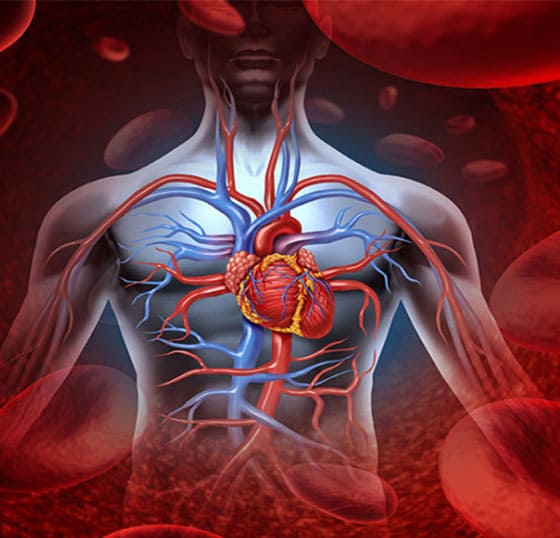 Coronary Artery Disease